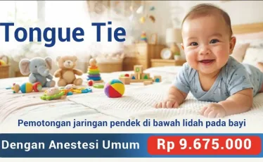 Paket Tongue Tie